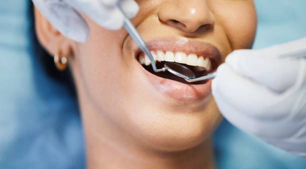 Best Knocked-Out Tooth (Avulsed Tooth) Treatment in Ridgetop, TN