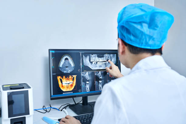 Best Emergency Wisdom Tooth Extraction in Ridgetop, TN